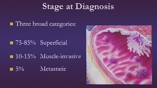 Bladder Cancer [upl. by Hctim]